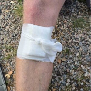 Wilderness first aid TBS Torbjörn 2